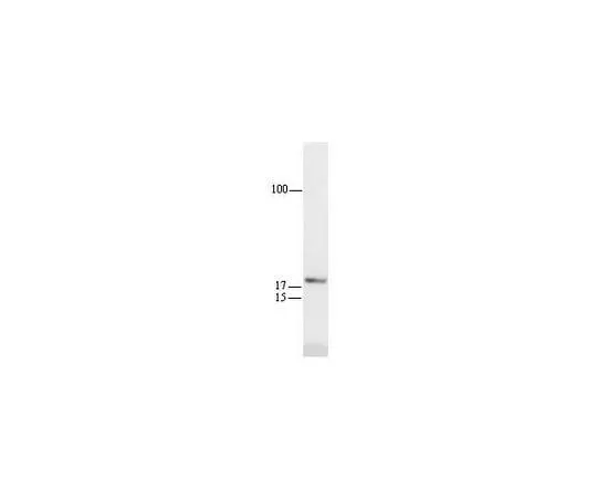 62-8529-17　抗p21WAF1 (Ab-1) 小鼠mAb (EA10)　OP64-20UG