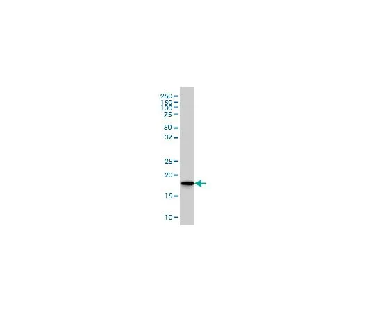 62-8534-18　抗SKP1A小鼠mAb (1H8)　ST1709-100UG