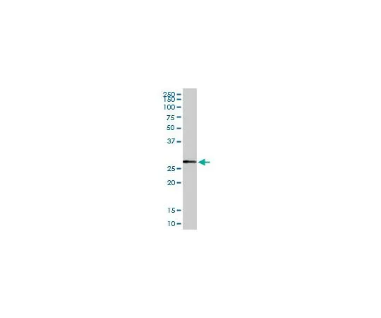 62-8533-63　抗NQO1兔pAb　ST1535-100UG