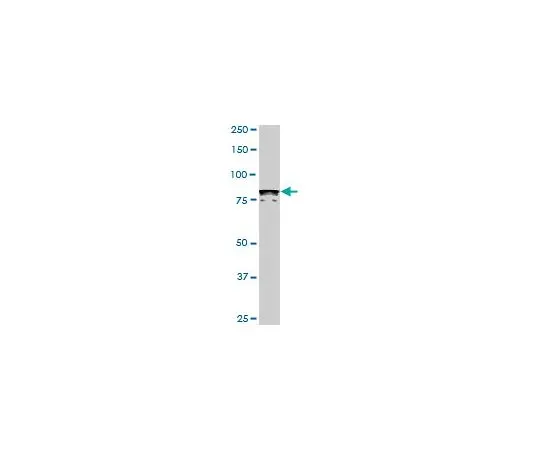 62-8533-98　抗DYRK1A小鼠mAb (7D10)　ST1650-100UG