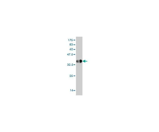 62-8533-84　抗HPSE小鼠mAb (4D7)　ST1611-100UG