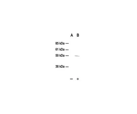 62-8529-88　磷检测 (TM) 抗p53 (pSer15) (Ab-3) 兔pAb　PC386-50UL