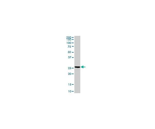 62-8478-89　抗TNNI2兔pAb　CB1048-100UG