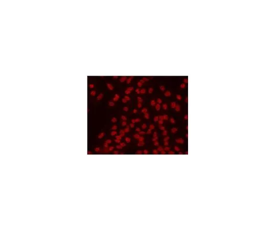 62-8528-15　抗-2,2,7-三甲基鸟苷小鼠mAb (K121)　NA02-100UG