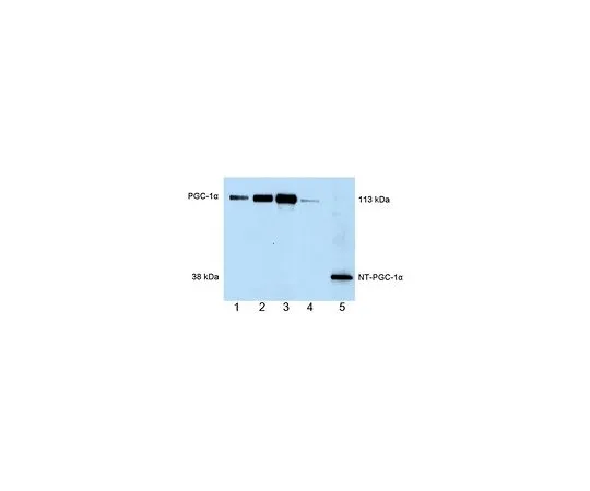 62-8533-49　抗PGC-1α小鼠mAb (4C1.3)　ST1202-1SET