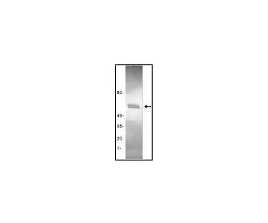 62-8485-81　抗组织纤溶酶原激活物 (Ab-1) 小鼠mAb (GMA-043)　GF53-100UG