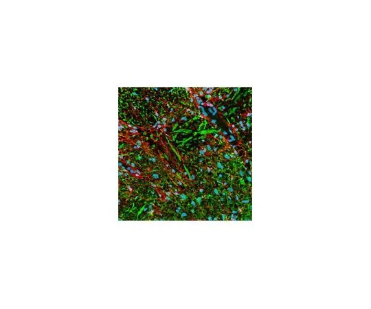 62-8528-43　磷检测 (TM) 抗神经丝-H小鼠mAb (SMI-31)　NE1022-100UL