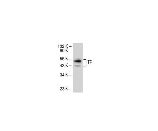62-8440-96　抗组织因子小鼠mAb (TF9-10H10)　612161-500UG