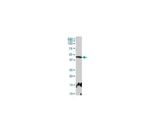 62-8481-49　抗E2F2兔pAb　DR1095-100UG