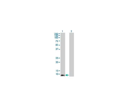 62-8533-70　抗DEFB4小鼠mAb (4C4)　ST1568-100UG