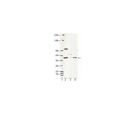 62-8411-33　抗钙网蛋白 (405-417) 兔pAb　208910-50UL