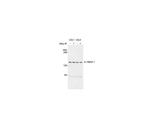 62-8481-27　抗RENT1山羊pAb　DR1015-100UG