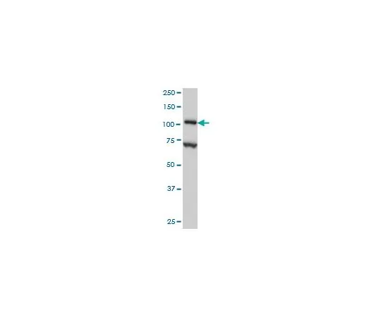 62-8534-03　抗DPYD小鼠mAb (7D4)　ST1672-100UG