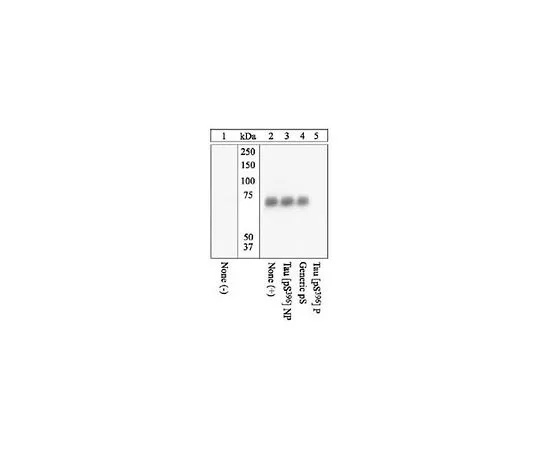 62-8440-13　磷检测 (TM) 抗桃 (pSer396) 兔pAb　577815-10T