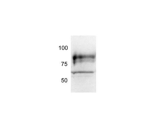 62-8533-45　抗TORC2 (454-607) 兔pAb　ST1099-50UL