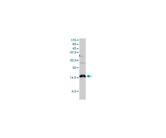 62-8478-87　抗CLDN1小鼠mAb (1C5-D9)　CB1046-100UG