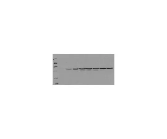 62-8533-35　PhosphoDetect (TM) Anti-Fos (pSer374) Mouse mAb (34E4)　ST1029-1SET