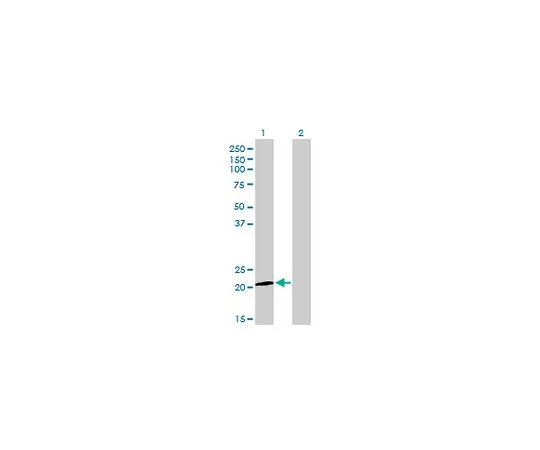 62-8481-43　抗ATF3小鼠mAb (6B8)　DR1086-100UG