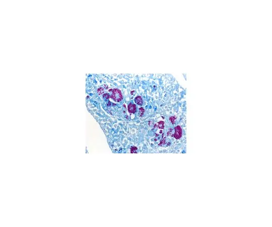 62-8535-05　ISOSLIDE (R) AFB对照幻灯片，参考组织检测组织学组织中的分枝杆菌　1.02560.0001