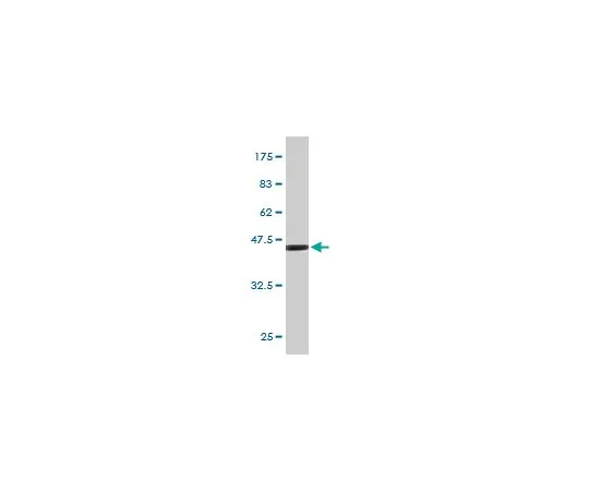 62-8533-86　抗FGF21小鼠mAb (2F11)　ST1615-100UG