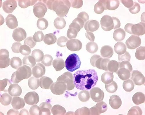 61-0306-36　Giemsa的Azur-Eosin-MethyleneBlue (粉末) ，用于显微镜109203 100G　1.09203.0100