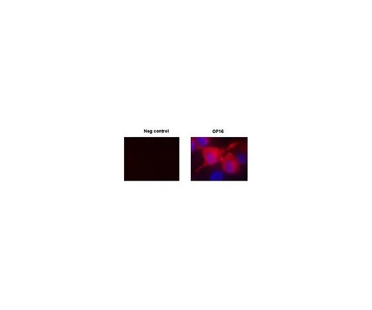 62-8528-87　抗c-ErbB2/c-Neu (Ab-4) 小鼠mAb (7.16.4)　OP16-100UG