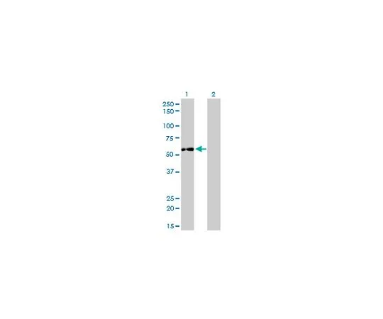 62-8533-73　抗IMPDH2小鼠mAb (1E12-B6)　ST1578-100UG