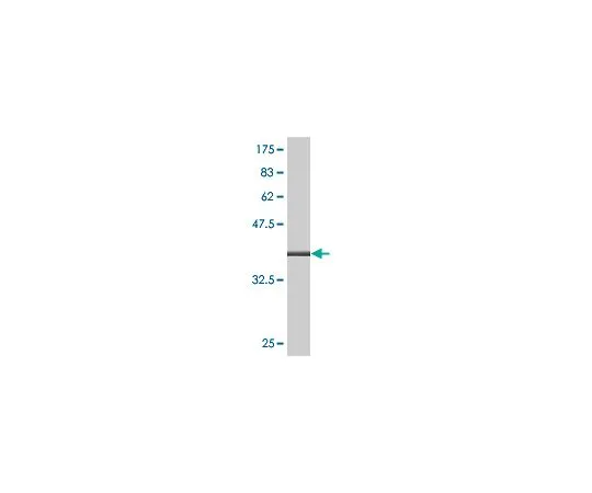 62-8533-68　抗ALOX12小鼠mAb (2D10)　ST1558-100UG