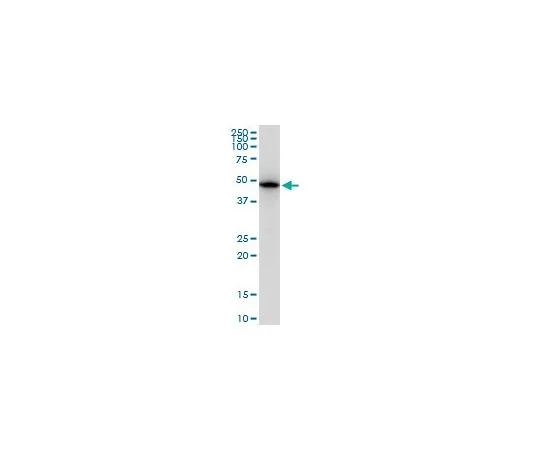 62-8478-91　抗TUBB2A小鼠mAb (2B2)　CB1052-100UG