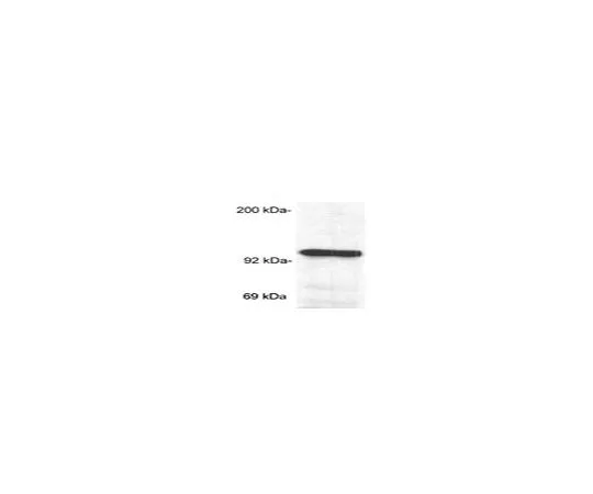 62-8487-40　抗糖皮质激素受体 (Ab-2) 小鼠mAb (BuGR2)　GR32L-100UG