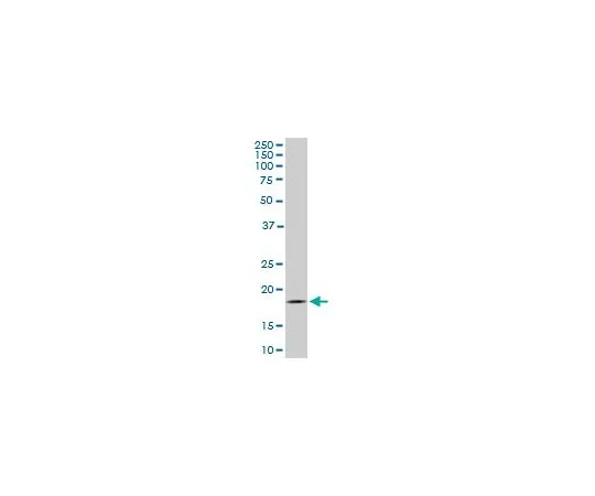 62-8534-16　抗TOMM22小鼠mAb (4G4)　ST1704-100UG