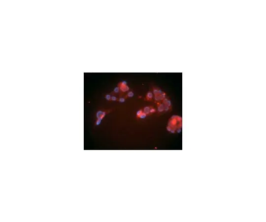 62-8488-19　抗LDL受体小鼠mAb (15C8)　LP02-100UG