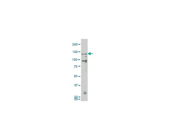 62-8533-96　抗MAP4K4小鼠mAb (4A5)　ST1641-100UG