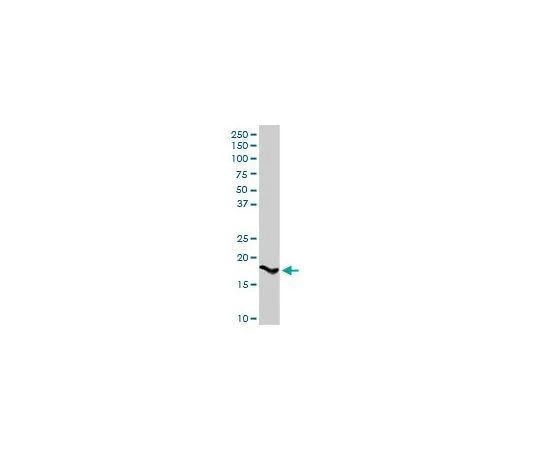 62-8477-58　抗SPINK1兔pAb　AP1142-100UG
