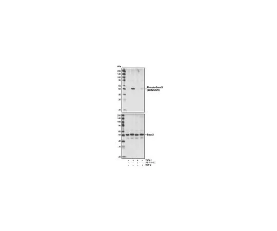 62-8530-62　磷检测 (TM) 抗Smad3 (pSer423/425) 兔mAb (C25A9)　PS1023-50UL