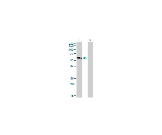 62-8533-58　抗PIP5K3小鼠mAb (6C7)　ST1517-100UG