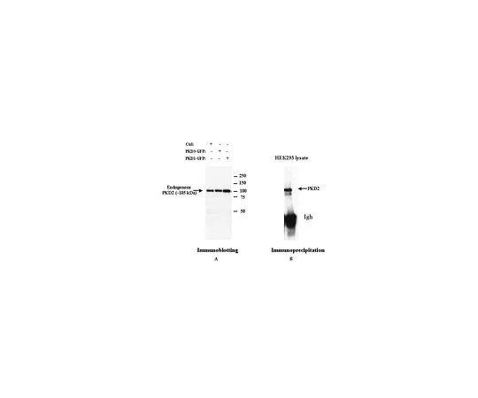 62-8533-38　抗PKD2兔pAb　ST1042-50UG