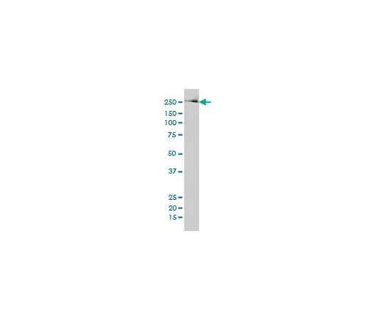 62-8533-65　抗FASN小鼠mAb (3F2-1F3)　ST1549-50UG