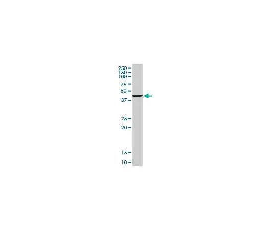 62-8533-83　抗TANK兔pAb　ST1608-100UG