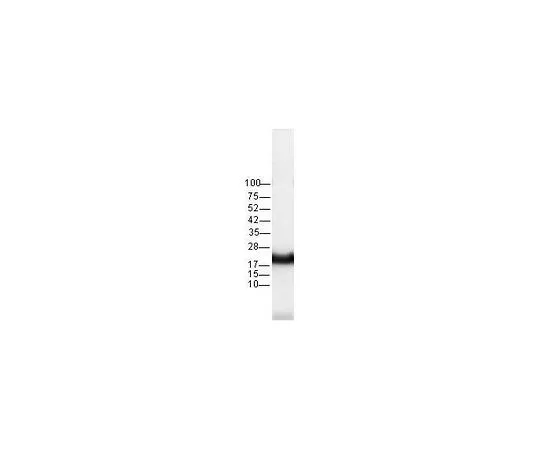 62-8529-07　反泛Ras (Ab-3) Mouse mAb (RAS 10)　OP40-100UG