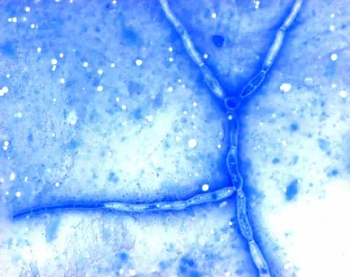 61-0320-93　Chromolith (R) Semiprep Si100-10mm152015 1 ST　1.52015.0001