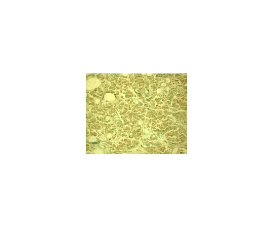 62-8529-38　抗MDM2 (Ab-3) 小鼠mAb (4B11)　OP143-100UG