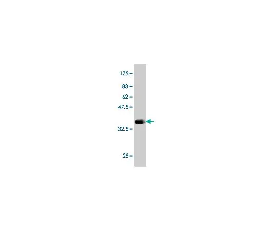 62-8477-56　抗ARSB小鼠mAb (1A4)　AP1139-100UG