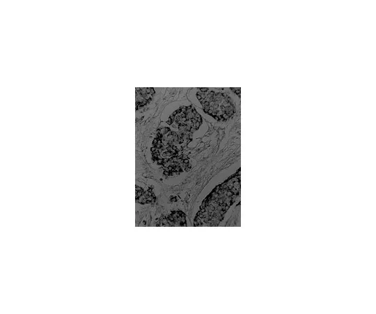 62-8371-19　［已停用］抗VEGF,克隆JH;100μg　05-443