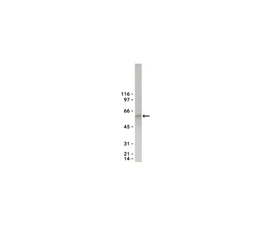 62-8371-87　［已停用］抗Akt/PKB, PH域，克隆SKB1;1毫克　05-591MG