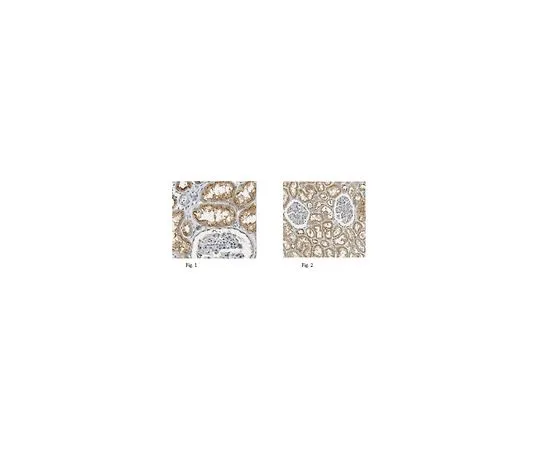 62-8457-25　［已停用］抗OGG1　ABC237