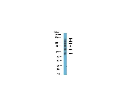 62-8466-06　［已停用］抗CEA细胞粘附分子16 (Ceacam16)　ABN190