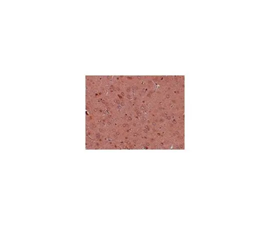 62-8467-61　［已停用］抗GOLPH2　ABN493