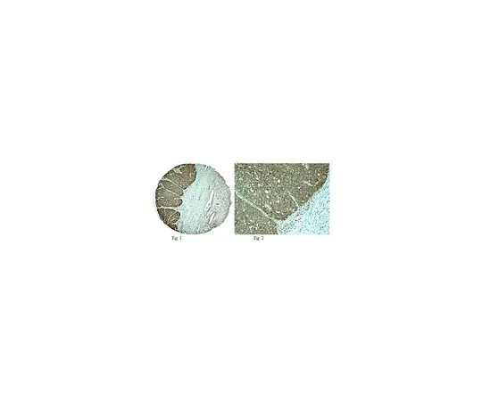 62-8446-93　［已停用］抗TIMP-2 (C末端);50μg　AB2965