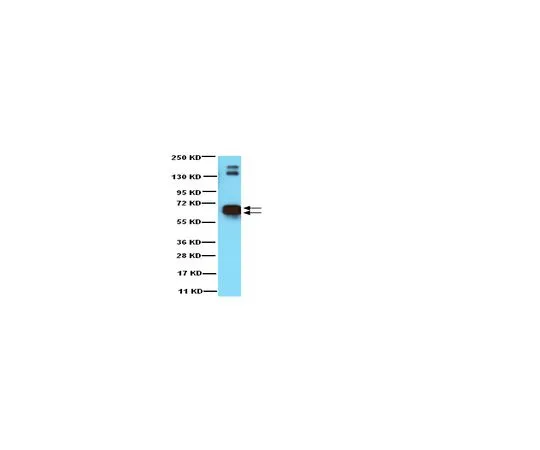 62-8445-04　［已停用］抗谷氨酸脱羧酶65和67;50μL　AB1511